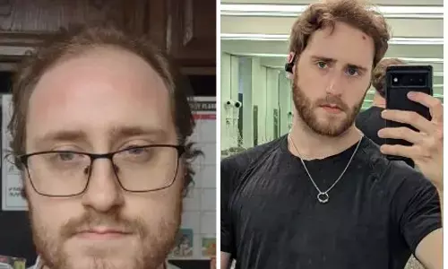 रिलेशनशिप में रहते-रहते बूढ़ा हुआ शख्स, ब्रेकअप के 10 साल बाद इस तरह हुआ जवान, सोशल मीडिया पर शेयर की अपनी स्टोरी