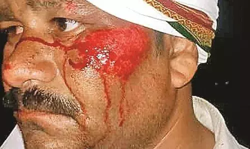 सेलू में दो हादसों में तीन गंभीर घायल, रात में हुई अलग - अलग घटनाएं