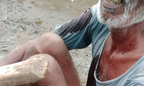 भैंसों ने बचाई मालिक की जान, बाघ के हमले में वृद्ध घायल भैंसों ने बचाई मालिक की जान, बाघ के हमले में वृद्ध घायल