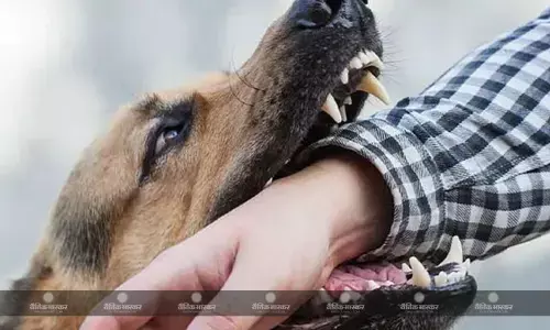 पालतू कुत्तों से हो जाएं सावधान नहीं तो जा सकती है आपकी जान, जानिए किन-किन जानवरों के काटने से फौलता है रेबीज