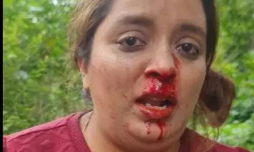 बच्चों के साथ जा रही महिला से मारपीट, नाक से निकला खून - वीडियो देख पुलिस हरकत में आई बच्चों के साथ जा रही महिला से मारपीट, नाक से निकला खून - वीडियो देख पुलिस हरकत में आई