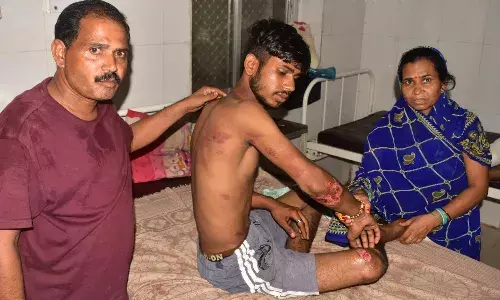 अगवा कर युवक की बेदम पिटाई, कपड़े उतारकर वीडियो भी बनाया, बकाया मांगने से भडक़े आरोपियों ने दिया घटना को अंजाम