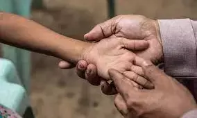कुष्ठरोगियों में महिलाओं का प्रमाण 50 फीसदी , स्वास्थ्य विभाग के कार्यक्रम में खुलासा