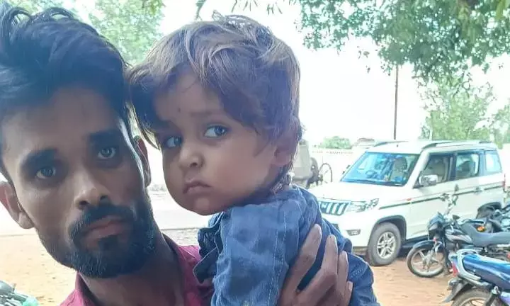 बच्ची को ओपीवी का टीका लगाने के बाद बुरी तरह पका