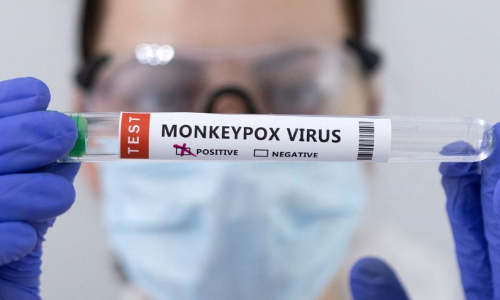 भारत में मिला मंकीपॉक्स का संदिग्ध मामला, मरीज को अस्पताल में किया गया आईसोलेट