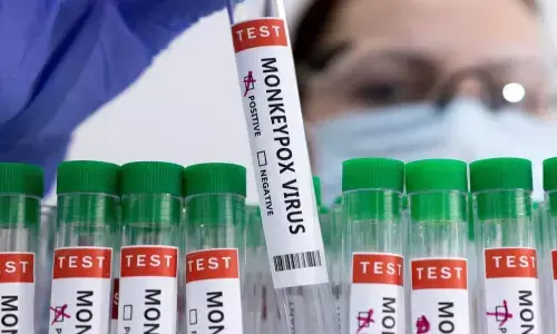 विदेश से लौटे एक व्यक्ति में पाया गया वायरस, स्वास्थ्य मंत्रालय ने की पुष्टि, जारी की एडवाइजरी