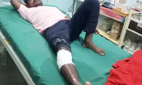 बाघिन ने मार्ग से गुजर रहे दोपहिया सवार पर अचानक मारी झड़प