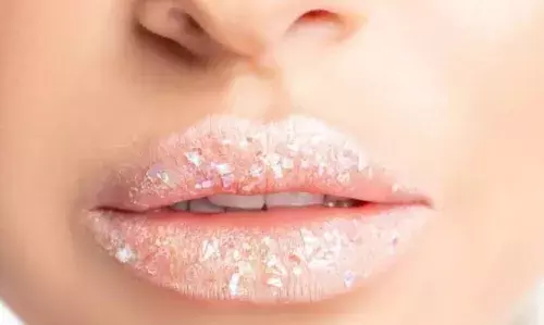 ठंड में रूखे-सूखे होने के बाद फट जाते हैं होंठ, तो ठंड में ऐसे रखें अपने होंठों का ख्याल, नहीं होंगे खराब
