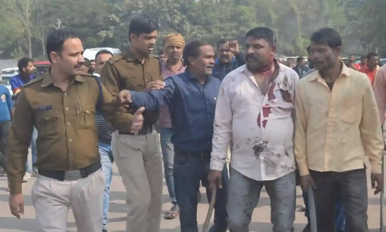 बोलेरो से आए युवकों ने पार्किंग मैनेजर को पीटा