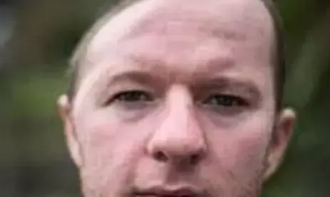 आधे सर के साथ जिंदगी गुजार रहा यह शख्स! एक हादसे से छीन गई थी सारी खुशियां, ऑपरेशन के बाद अब ऐसी है हालत