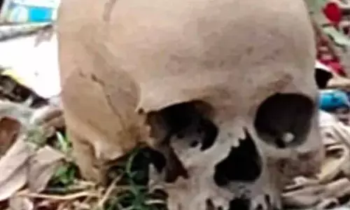 अमरावती में कचरे के ढेर में मिली मानव खोपड़ी , लोगों में दहशत अमरावती में कचरे के ढेर में मिली मानव खोपड़ी , लोगों में दहशत