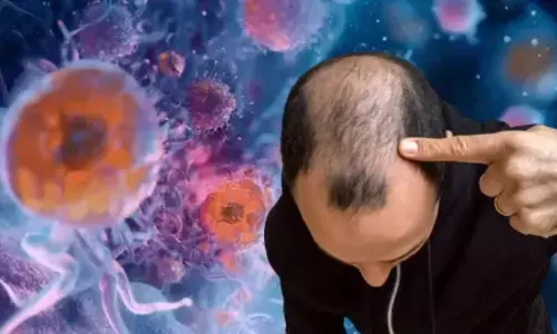 महाराष्ट्र में तेजी से पैर पसार रहा टकला वायरस, खुजली के 2 से 3 दिन में लोगों के सिर से जा रहे बाल, अब तक 40 लोगों हुए शिकार