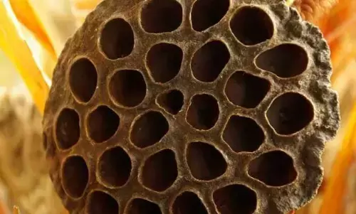 अगर एक तरह के पैटर्न्स देखकर आपको भी लगता है डर, तो इस फोबिया के हो सकते हैं शिकार, जानें इसका इलाज