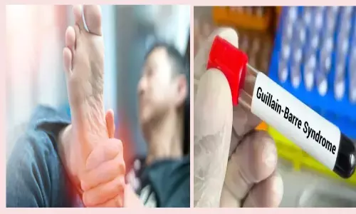 जीबीएस मरीज की पुष्टि, 64 साल की महिला संक्रमित, सेवन हिल अस्पताल में इलाज