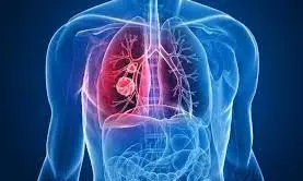 अब पॉलीक्लीनिक-प्रसूतिगृह में होगी ओरल, स्तन और गर्भाशय कैंसर की जांच