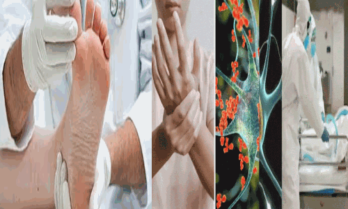 जीबीएस से आठ की मौत, विपक्ष ने सरकार को घेरा, पानी जांच का सख्ती से पालन का निर्देश