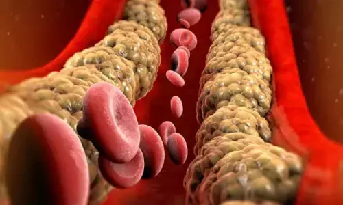 दिल की बीमारी से रहना चाहते हैं दूर, तो इन आदतों को लाइफस्टाइल में जरूर करें फॉलो, कंट्रोल में रहेगा बैड कोलेस्ट्रॉल