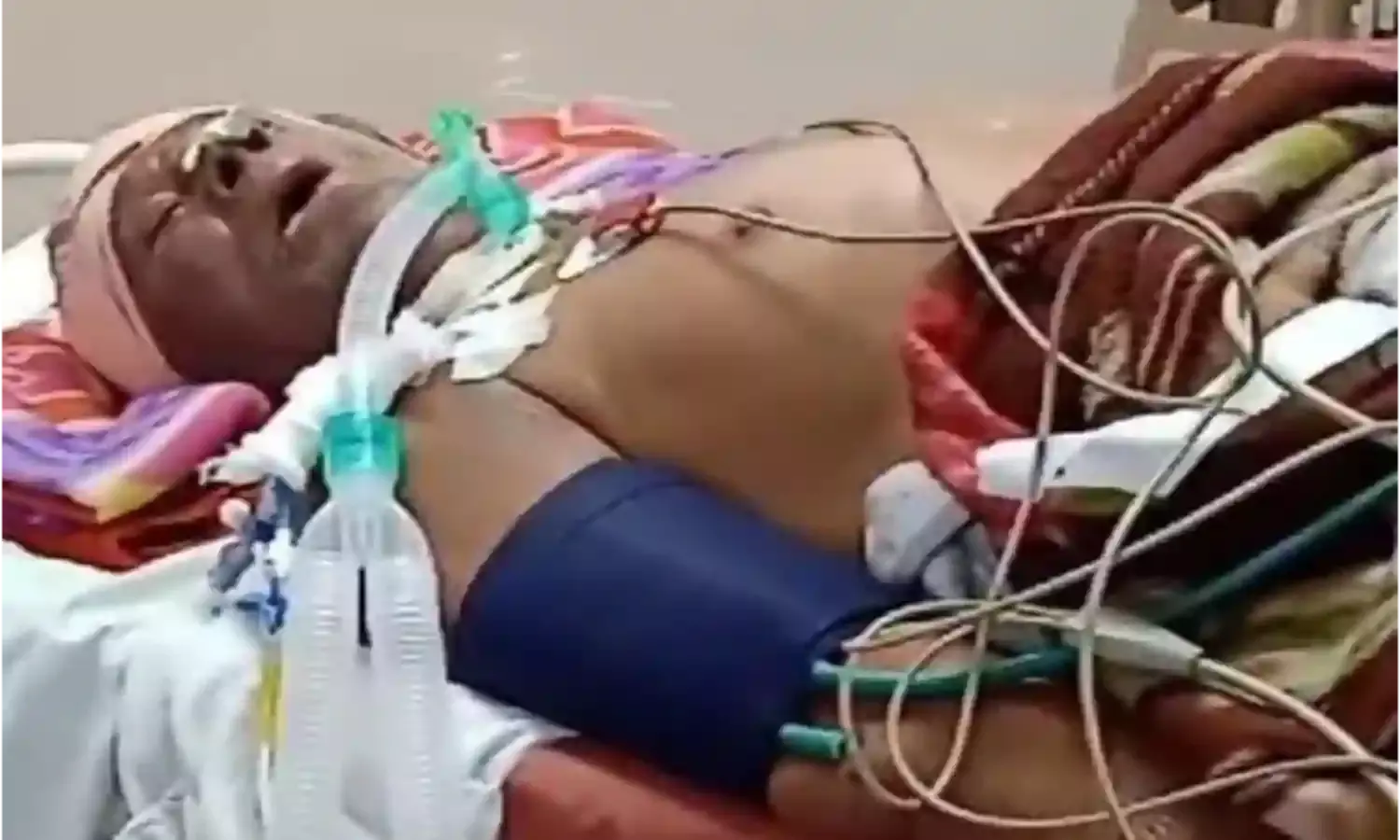 स्ट्रेचर पर 24 घंटे कराहता रहा किसान, उपचार के बजाय सर्कुलर पर बहस करते रहे दो डॉक्टर