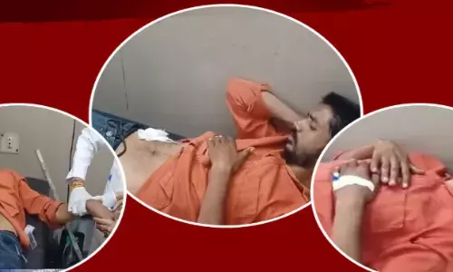 यूट्यूब वीडियो देखकर युवक ने कर डाला अपना ही ऑपरेशन, आगे क्या हुआ जानकर आप हो जाएंगे हैरान! यूट्यूब वीडियो देखकर युवक ने कर डाला अपना ही ऑपरेशन, आगे क्या हुआ जानकर आप हो जाएंगे हैरान!