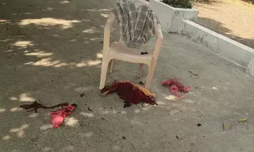 दादी सास को जिंदा जलाने वाली मनोरोगी बेटी ने पेट्राेल डालकर मां को जलाया दादी सास को जिंदा जलाने वाली मनोरोगी बेटी ने पेट्राेल डालकर मां को जलाया