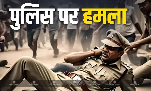 मुरादाबाद में अपराधी को अरेस्ट करने पहुंची पुलिस टीम, लोगों ने किया पथराव, 2 पुलिसकर्मी घायल, इलाज जारी