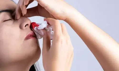 क्या गर्मियों में आपकी नाक से भी आता है खून? अगर हां तो हो जाएं सावधान, हो सकते हैं बीमारी के शिकार