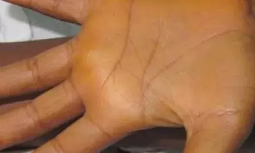 अगर आपके हाथ भी हो रहे हैं पीले तो हो जाएं सावधान, हो सकती हैं ये बीमारियां अगर आपके हाथ भी हो रहे हैं पीले तो हो जाएं सावधान, हो सकती हैं ये बीमारियां