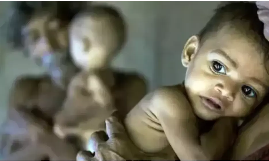 मुंबई उपनगर में गंभीर कुपोषित बच्चों की संख्या घटी, आशीष शेलार ने दी जानकारी मुंबई उपनगर में गंभीर कुपोषित बच्चों की संख्या घटी, आशीष शेलार ने दी जानकारी