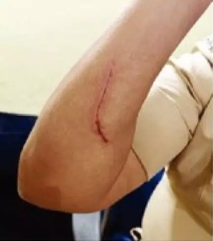 डीजे बंद करने को लेकर पुलिस निरीक्षक पर हमला, आरोपी के खिलाफ मामला दर्ज डीजे बंद करने को लेकर पुलिस निरीक्षक पर हमला, आरोपी के खिलाफ मामला दर्ज