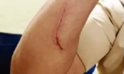 डीजे बंद करने को लेकर पुलिस निरीक्षक पर हमला, आरोपी के खिलाफ मामला दर्ज डीजे बंद करने को लेकर पुलिस निरीक्षक पर हमला, आरोपी के खिलाफ मामला दर्ज