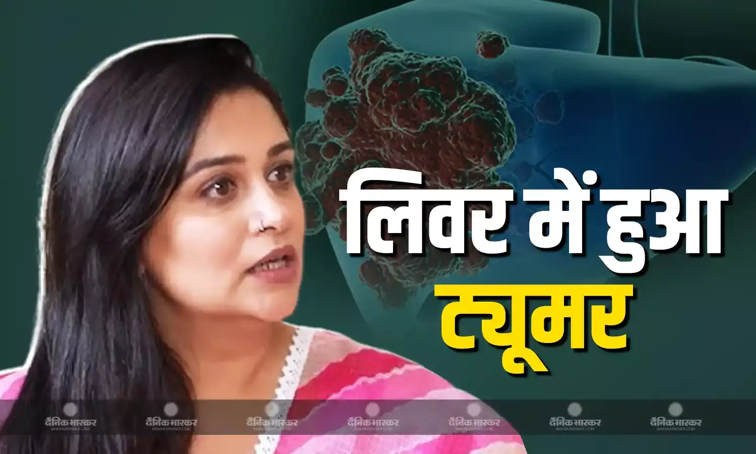 दीपिका कक्कड़ के लिवर में हुआ ट्यूमर, बेटे रूहान को लेकर हुई टेंशन, पति शोएब इब्राहिम ने दिया अपडेट