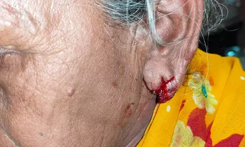 झपटा मारकर बुजुर्ग महिला के काने से सोने की बाली छिनी, घायल कर फरार हुए आरोपी झपटा मारकर बुजुर्ग महिला के काने से सोने की बाली छिनी, घायल कर फरार हुए आरोपी