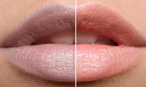 अगर आपके होंठ भी हैं काले, तो ये हो सकती है वजह, जानें कैसे किया जाए ठीक अगर आपके होंठ भी हैं काले, तो ये हो सकती है वजह, जानें कैसे किया जाए ठीक