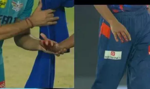 LSG-DC मैच में दिखा खौफनाक मंजर! चोटिल हुआ खिलाड़ी, बीच मैदान में बहने लगा खून