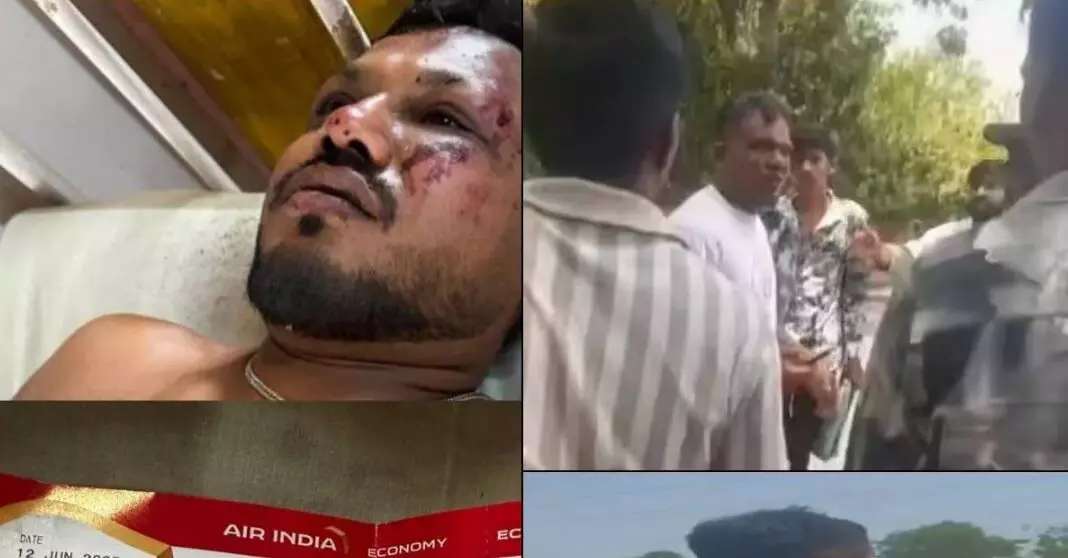 जब मैं उठा, मेरे चारों तरफ थीं लाशें, विमान हादसे में जिंदा बचे विश्वास कुमार रमेश ने सुनाई आपबीती जब मैं उठा, मेरे चारों तरफ थीं लाशें, विमान हादसे में जिंदा बचे विश्वास कुमार रमेश ने सुनाई आपबीती