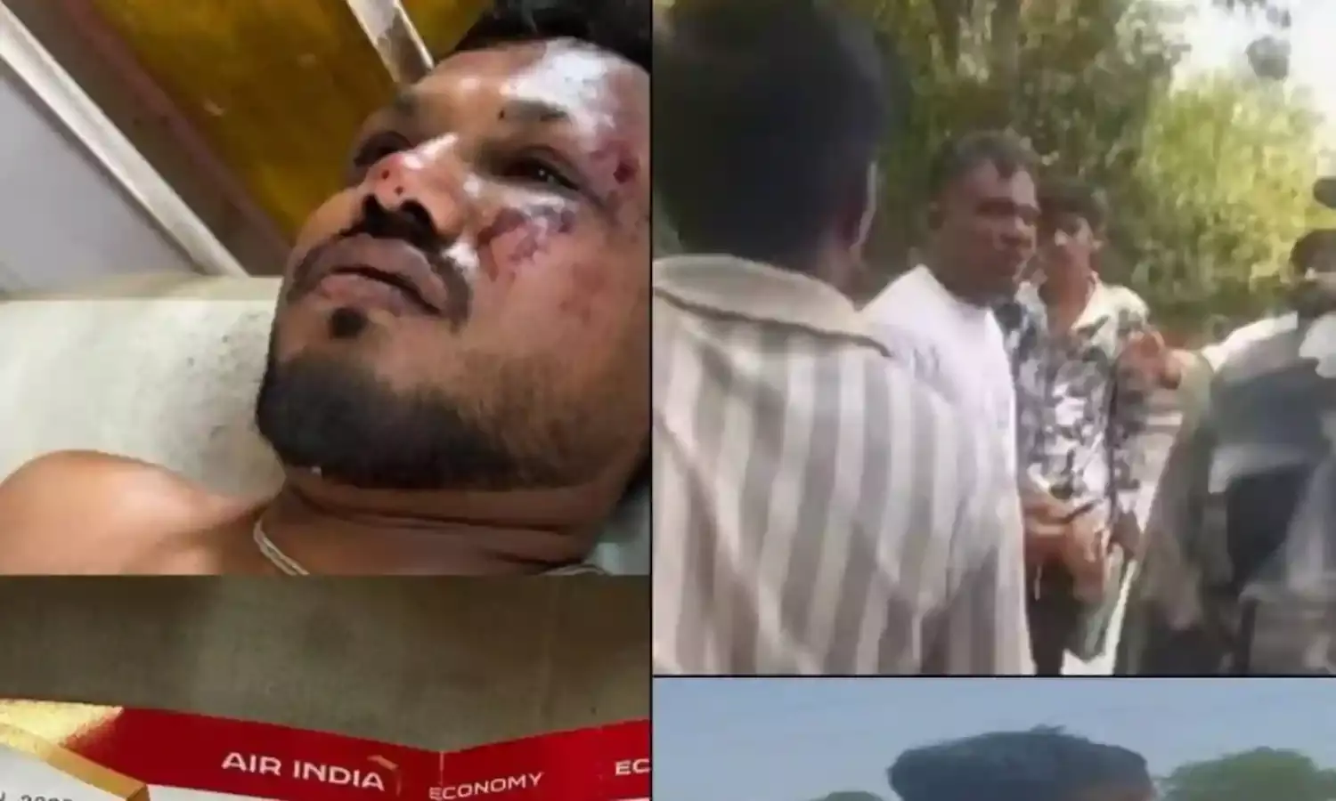 जब मैं उठा, मेरे चारों तरफ थीं लाशें, विमान हादसे में जिंदा बचे विश्वास कुमार रमेश ने सुनाई आपबीती