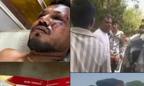 जब मैं उठा, मेरे चारों तरफ थीं लाशें, विमान हादसे में जिंदा बचे विश्वास कुमार रमेश ने सुनाई आपबीती