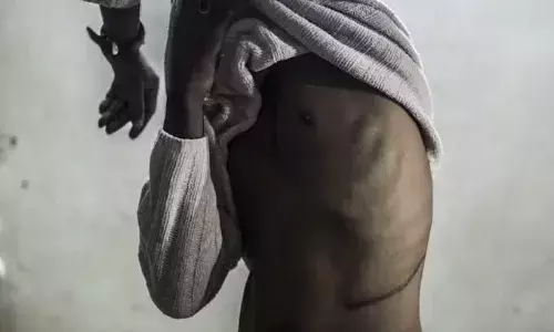 वन किडनी विलेज के नाम से कुख्यात हो चुका बांग्लादेश का यह गांव, भारत आकर किडनी बेच रहे लोग