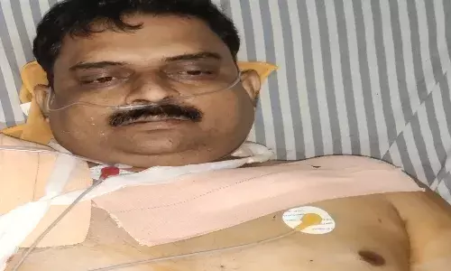 अज्ञात बदमाशों ने होटल संचालक को मारी गोली, घटना स्थल से मिला खाली कारतूस
