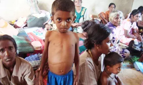 अमरावती जिले में 508 बाल मृत्यु , सर्वाधिक 141 कुपोषित मेलघाट में