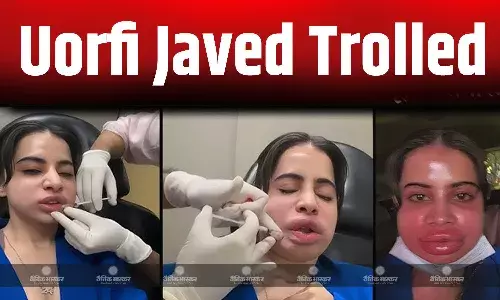 उर्फी जावेद ने हटवाए अपने लिप फिलर्स तो हुईं ट्रोल, जानिए क्या होते हैं लिप फिलर्स और कितनी कीमत में होती है सर्जरी?
