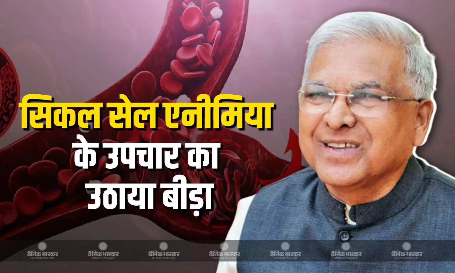 सिकल सेल एनीमिया के उपचार के लिए लघु वनोपज संघ ने बनाई तीन औषधियां सिकल सेल एनीमिया के उपचार के लिए लघु वनोपज संघ ने बनाई तीन औषधियां