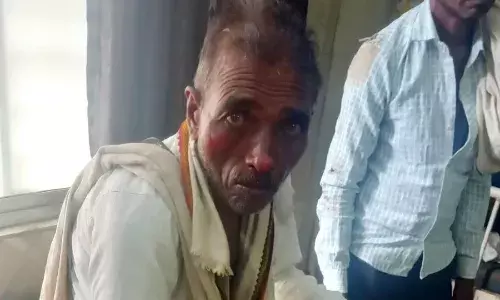 गंगाझिरिया मार्ग पर सडक़ हादसा, महिला सहित दो लोग हुए घायल