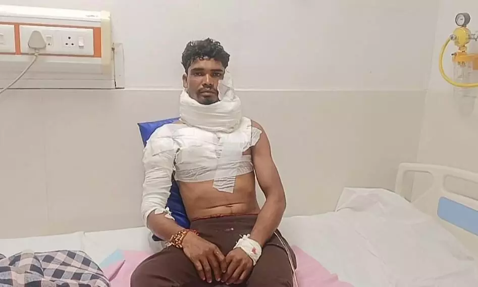 टाइगर का अटैक...खेत में काम कर रहे युवक पर किया हमला टाइगर का अटैक...खेत में काम कर रहे युवक पर किया हमला