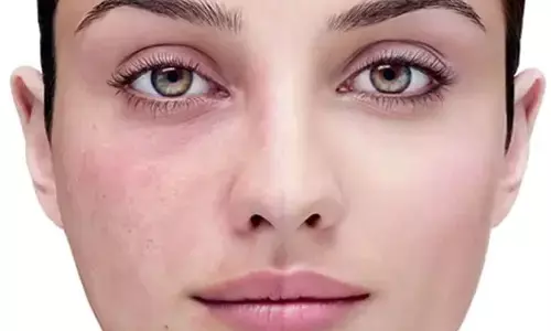सर्दियों में फटने लगते हैं गाल तो, ट्राई करें ये होममेड फेस पैक, सेंसिटिव स्किन के लिए भी शादार ऑप्शन सर्दियों में फटने लगते हैं गाल तो, ट्राई करें ये होममेड फेस पैक, सेंसिटिव स्किन के लिए भी शादार ऑप्शन