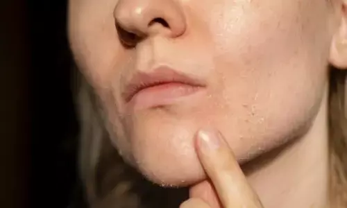 आपकी भी है ड्राई स्किन, तो सर्दियों में ऐसे रखें उसका खास ख्याल, यहां देखें टिप्स