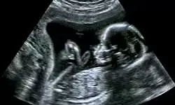 रैकेट का पर्दाफाश - सोनोग्राफी सेंटर सील, 2 डॉक्टरों के खिलाफ दर्ज हुआ मामला रैकेट का पर्दाफाश - सोनोग्राफी सेंटर सील, 2 डॉक्टरों के खिलाफ दर्ज हुआ मामला