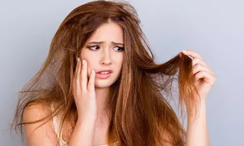 सर्दियों में बाल हो जाते हैं बेजान, तो इन घरेलू उपायों से रुखेपन को करें दूर, बनाएं अपने बालों को शाइनी