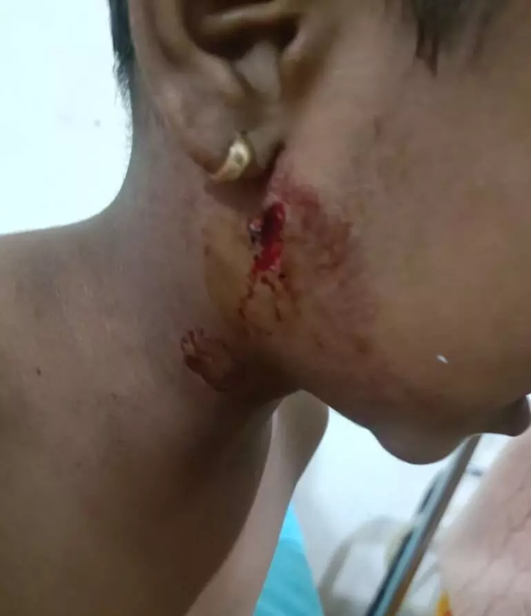 5 वर्षीय मासूम पर तेंदुए का हमला, मां के साहस से बची जान 5 वर्षीय मासूम पर तेंदुए का हमला, मां के साहस से बची जान