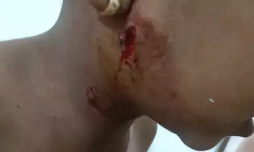 5 वर्षीय मासूम पर तेंदुए का हमला, मां के साहस से बची जान